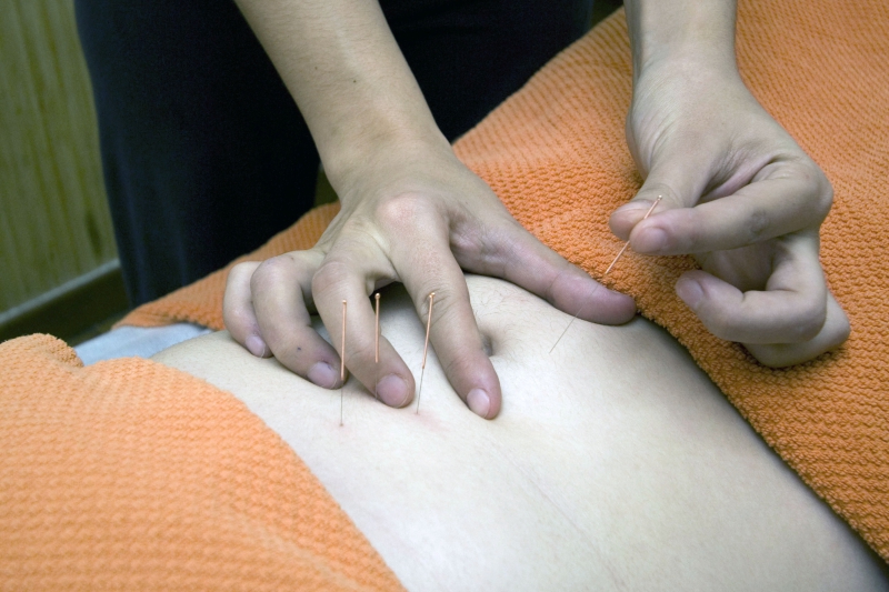 osteopathe-ROUBION-min_acupuncture-4175625